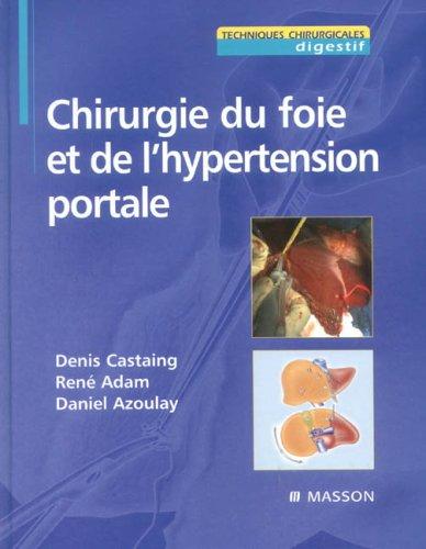 Chirurgie du foie et de l'hypertension portale