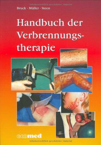 Handbuch der Verbrennungstherapie