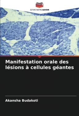 Manifestation orale des lésions à cellules géantes