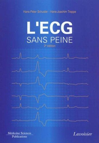 L'ECG sans peine