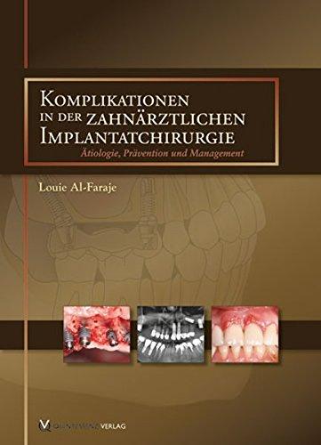 Komplikationen in der zahnärztlichen Implantatchirurgie: Ätiologie, Prävention und Management