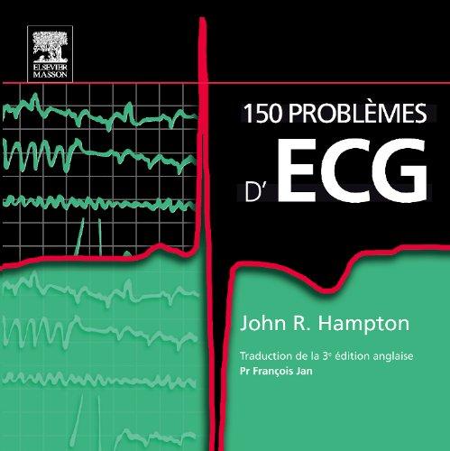 150 problèmes d'ECG