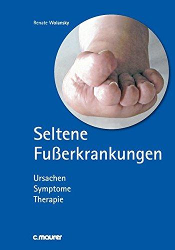 Seltene Fußerkrankungen: Ursache Symptome Therapie