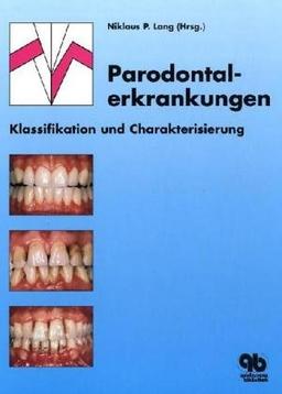 Parodontalerkrankungen: Klassifikation und Charakterisierung