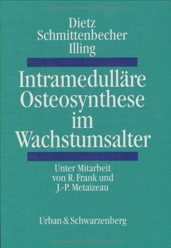 Intramedulläre Osteosynthese im Wachstumsalter