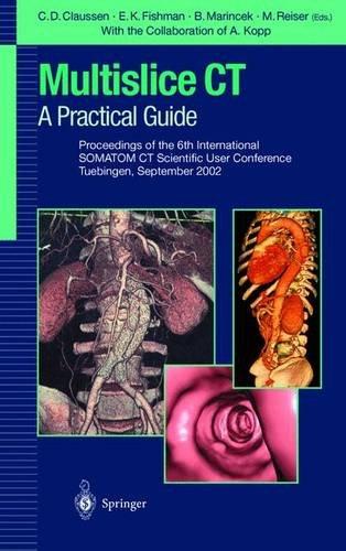 Multislice CT: A Practical Guide: Proceedings of the 5th International SOMATOM CT Scientific User Conference Zurich, June 2000