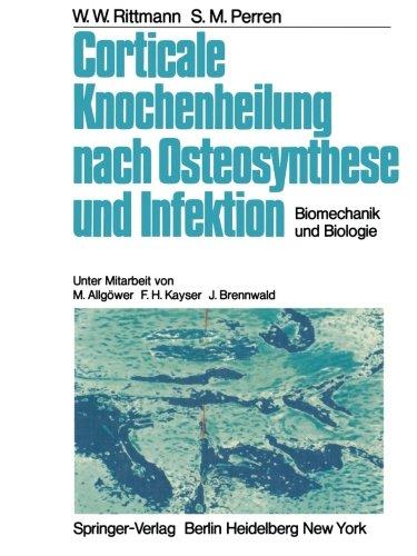 Corticale Knochenheilung nach Osteosynthese und Infektion: Biomechanik und Biologie (German Edition)