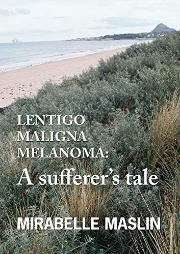 Lentigo Maligna Melanoma: A Sufferer's Tale