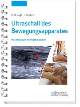 Ultraschall des Bewegungsapparates: Praxishandbuch mit Vergleichsbildern