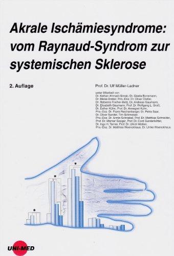 Akrale Ischämiesyndrome: vom Raynaud-Syndrom zur systemischen Sklerose