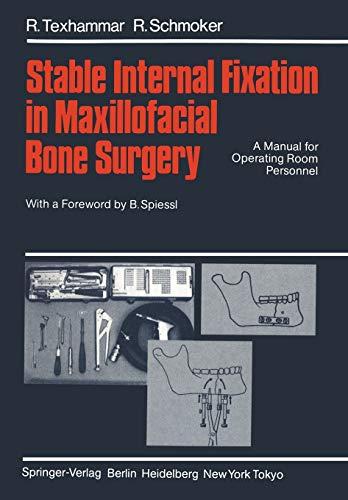 Stable Internal Fixation in Maxillofacial Bone Surgery: A Manual for Operating Room Personnel