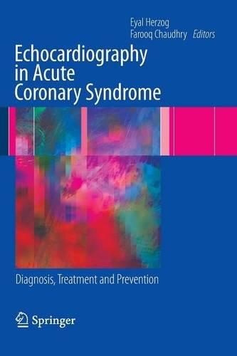 Echocardiography in Acute Coronary Syndrome: Diagnosis, Treatment and Prevention