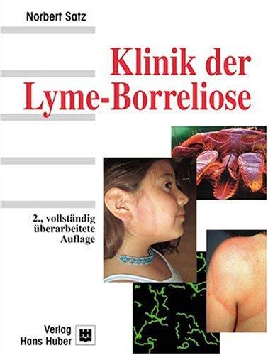 Klinik der Lyme - Borreliose