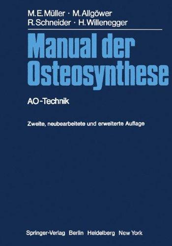 Manual der Osteosynthese: AO-Technik