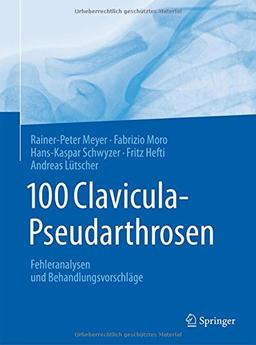 100 Clavicula-Pseudarthrosen: Fehleranalysen und Behandlungsvorschläge