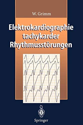 Elektrokardiographie tachykarder Rhythmusstörungen