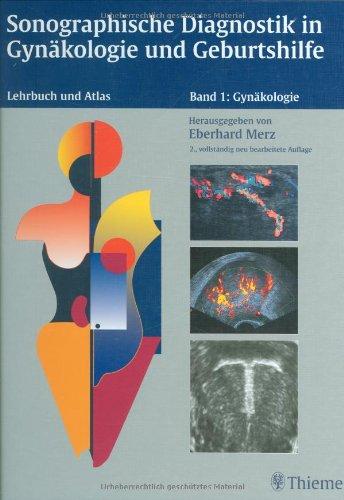 Sonographische Diagnostik in Gynäkologie und Geburtshilfe (in 2 Bdn.). Lehrbuch und Atlas: Sonographische Diagnostik in Gynäkologie und Geburtshilfe, 2 Bde., Bd.1, Gynäkologie