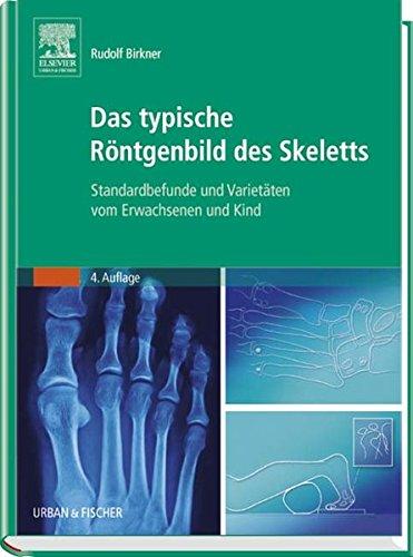 Das typische Röntgenbild des Skeletts: Standardbefunde und Varietäten vom Erwachsenen und Kind