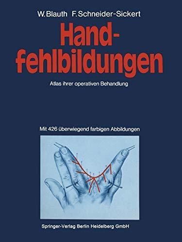 Handfehlbildungen: Atlas Ihrer Operativen Behandlung (German Edition)