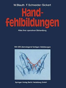 Handfehlbildungen: Atlas Ihrer Operativen Behandlung (German Edition)