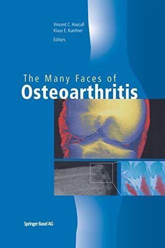 The Many Faces of Osteoarthritis