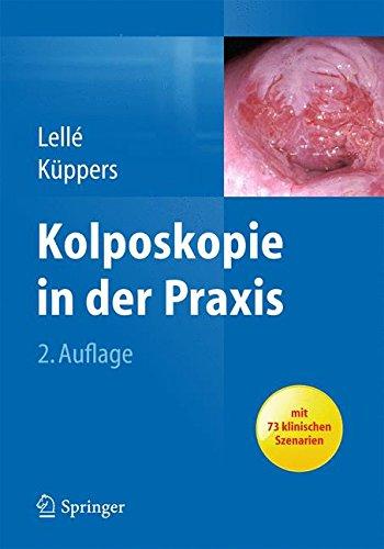 Kolposkopie in der Praxis