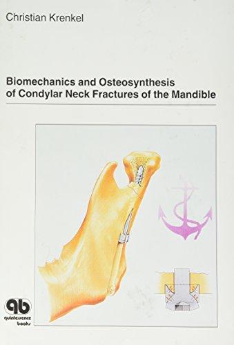 Biomechanics and Osteosynthesis of Condylar Neck Fractures of the Mandible