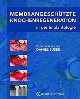 Membrangeschützte Knochenregeneration in der Implantologie