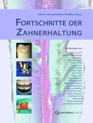 Fortschritte der Zahnerhaltung