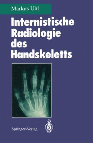 Internistische Radiologie des Handskeletts (German Edition)