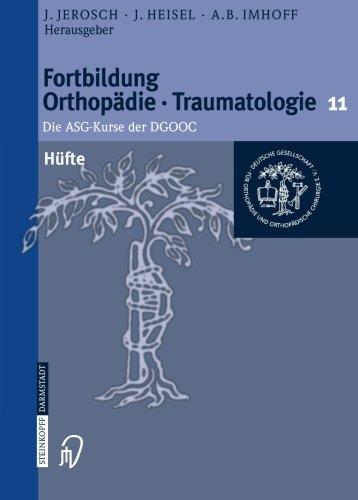 Hüfte: Die ASG-Kurse der DGOOC (Fortbildung Orthopädie - Traumatologie)