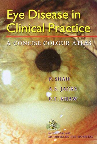 Eye Disease in Clinical Practice: A Concise Colour Atlas