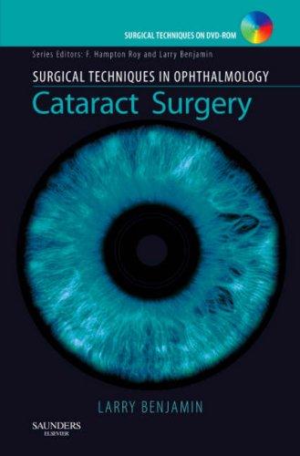 Cataract Surgery (Surgical Techniques in Ophthalmology)