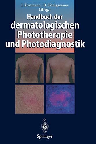 Handbuch der dermatologischen Phototherapie und Photodiagnostik