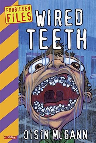 Wired Teeth (Forbidden Files)