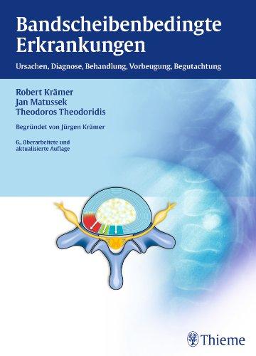 Bandscheibenbedingte Erkrankungen: Ursachen, Diagnose, Behandlung, Vorbeugung, Begutachtung