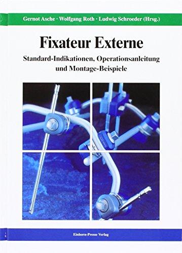 Fixateur Externe: Standard-Indikationen, Operationsanleitung und Montage-Beispiele