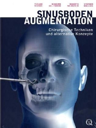 Sinusbodenaugmentation: Chirurgische Techniken und alternative Konzepte