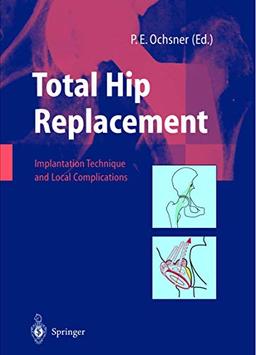 Total Hip Replacement: Implantation Technique and Local Complications