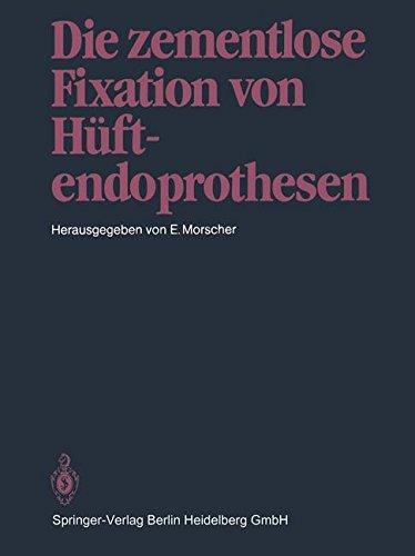 Die zementlose Fixation von Hüftendoprothesen