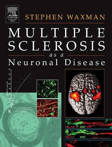 Multiple Sclerosis As A Neuronal Disease