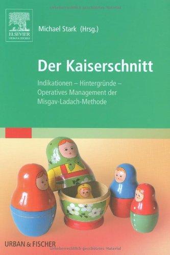 Der Kaiserschnitt: Indikationen. Hintergründe. Operatives Management der Misgav-Ladach-Methode