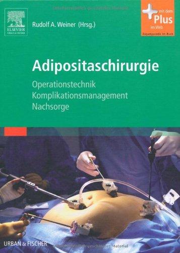 Adipositaschirurgie: Operationstechnik - Komplikationsmanagement - Nachsorge - mit Zugang zum Elsevier-Portal