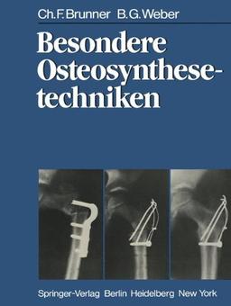 Besondere Osteosynthesetechniken