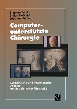 Computerunterstützte Chirurgie: Medizinische und informatische Aspekte am Beispiel einer Pilotstudie