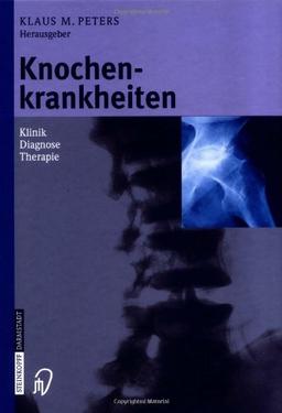 Knochenkrankheiten. Klinik - Diagnose - Therapie