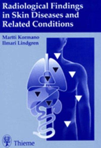 Radiologic Findings in Skin Disease and Related Conditions