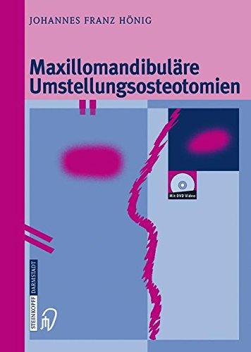 Maxillomandibuläre Umstellungsosteotomien (German Edition)