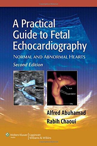 Practical Guide Fetal Echocardiography