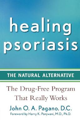 Healing Psoriasis: The Natural Alternative